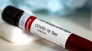 Намериха нови антитела срещу Covid-19